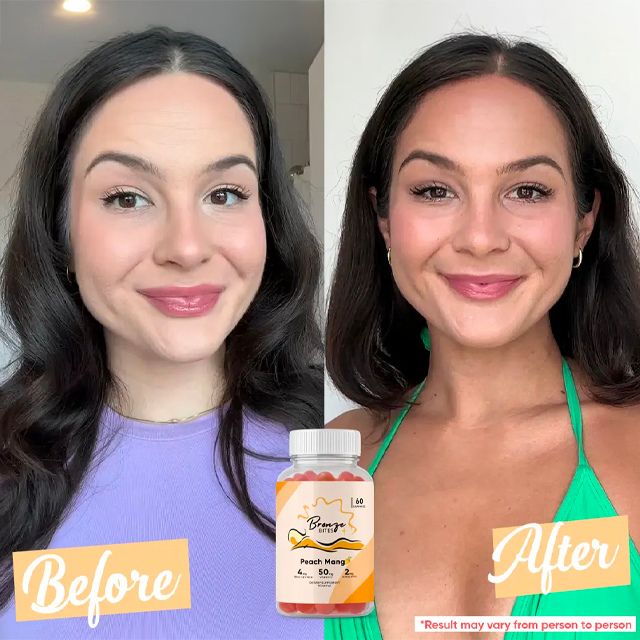 Glowyn Tanning Gummies