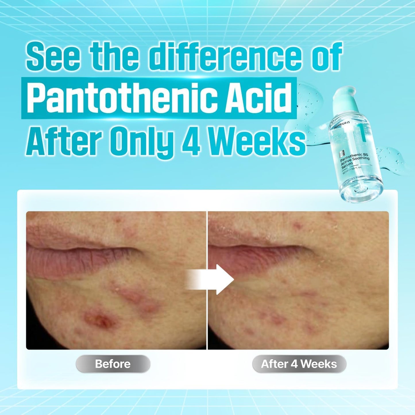 Glowyn Pantothenic Acid Serum