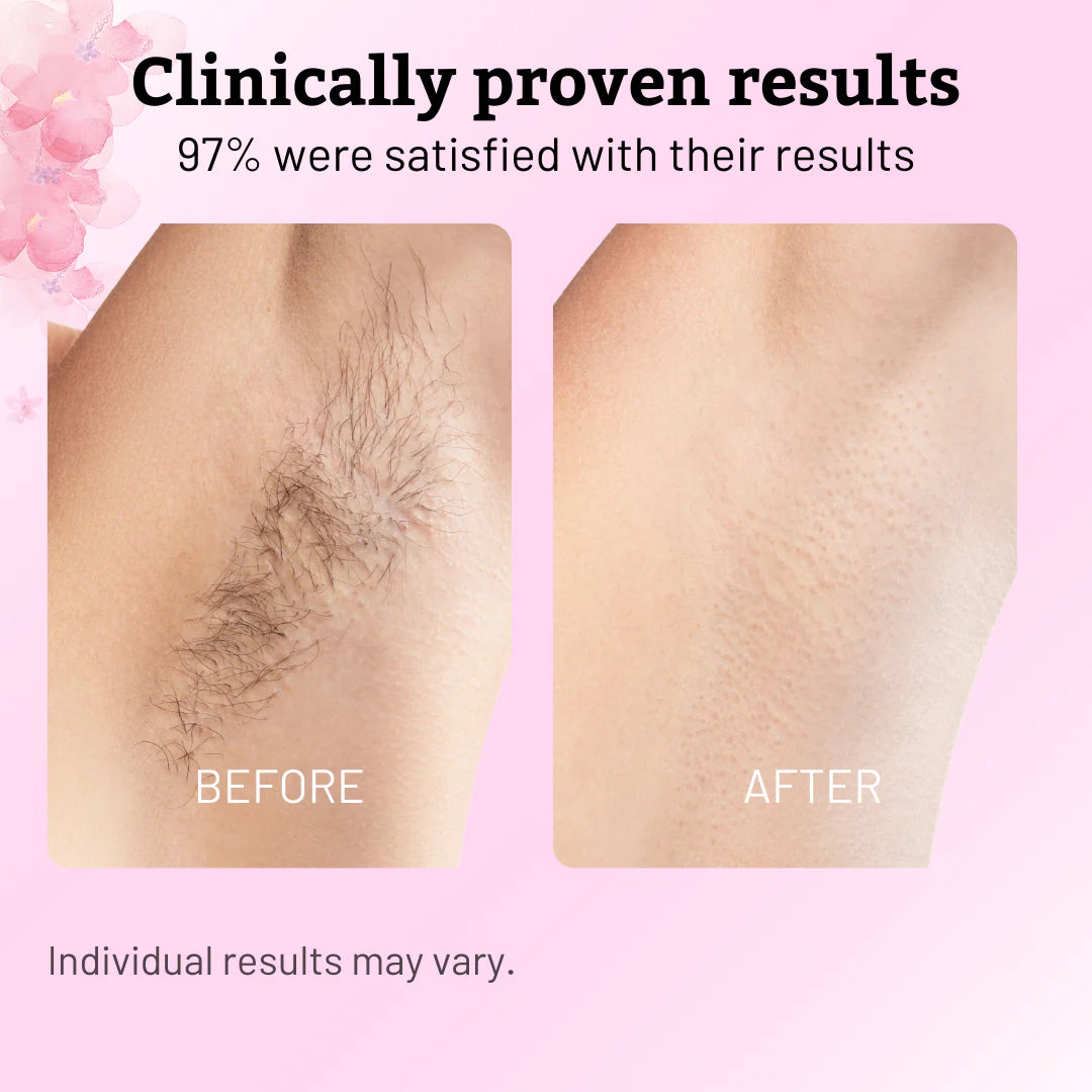 Glowyn Cyperus Hair Reduction Oil