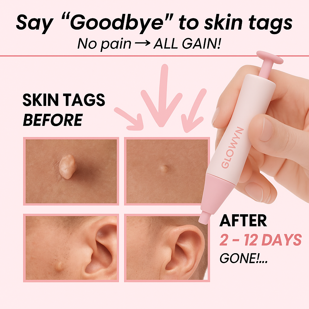Goodbye Tags Kit - No More Skin Tags