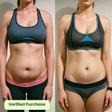 Glowyn Cellulite Smoothing System