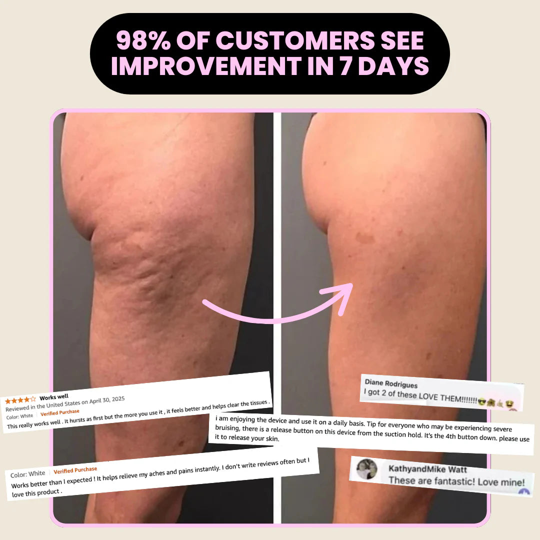Glowyn Cellulite Smoothing System