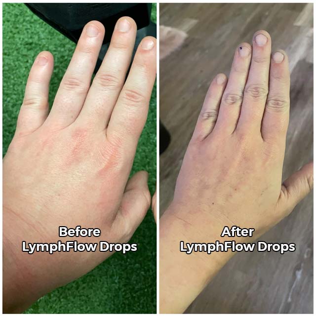 Glowyn LymphFlow Drops