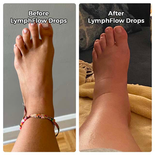 Glowyn LymphFlow Drops