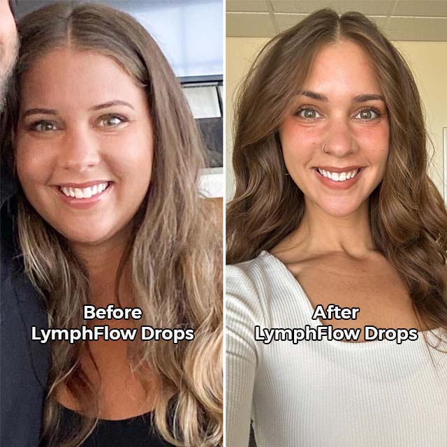 Glowyn LymphFlow Drops