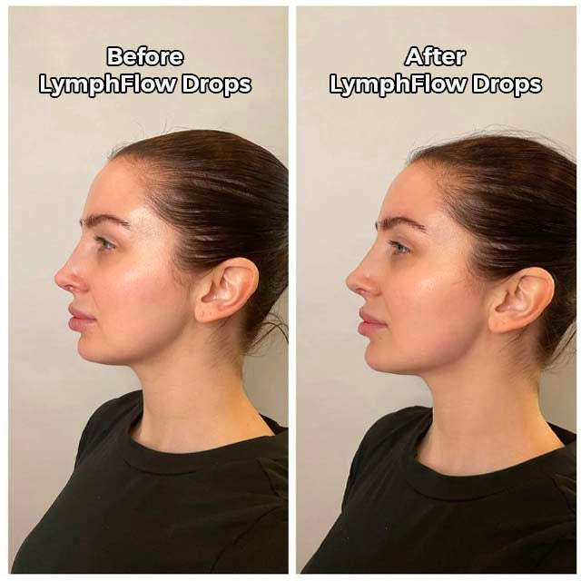 Glowyn LymphFlow Drops