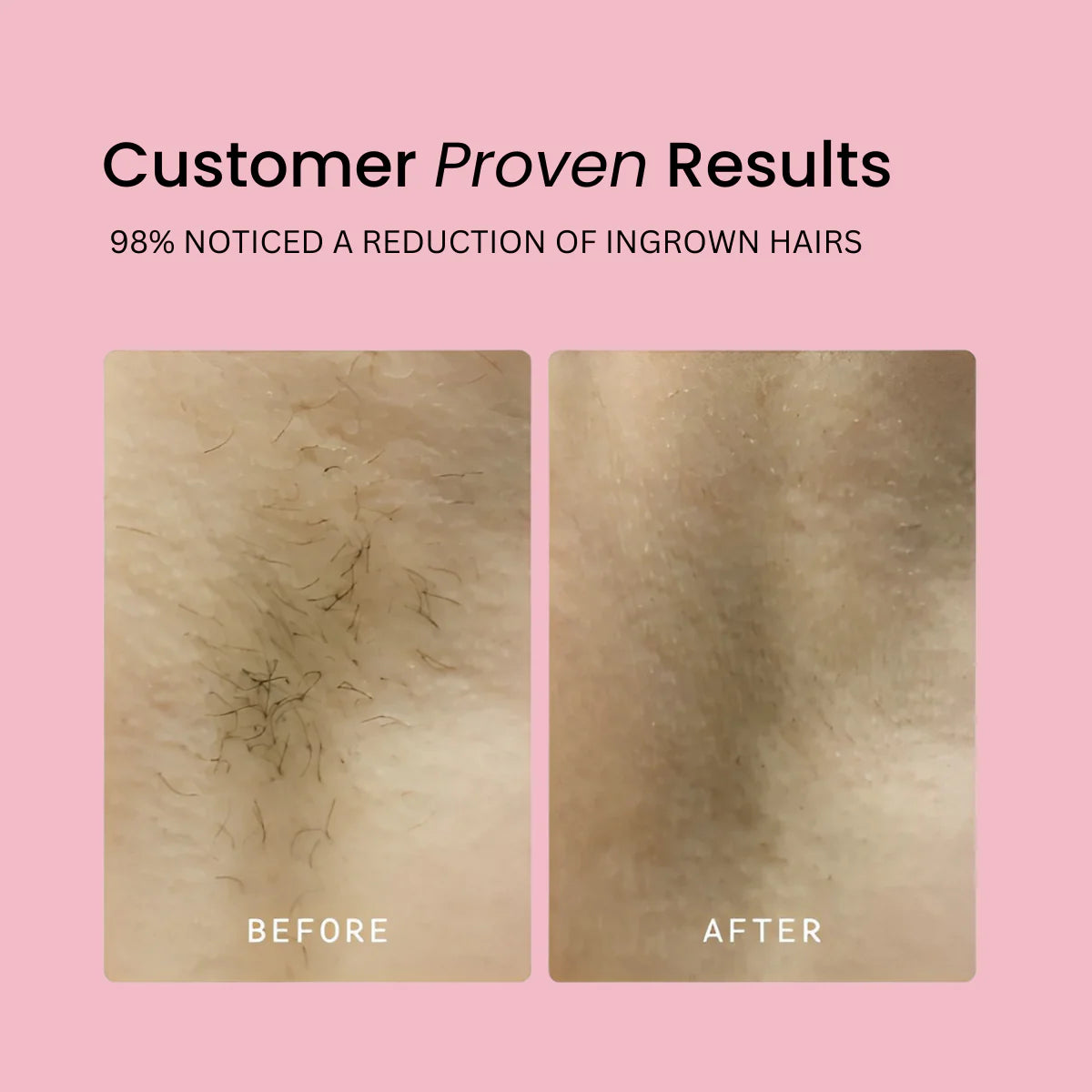 Glowyn Cyperus Hair Reduction Oil