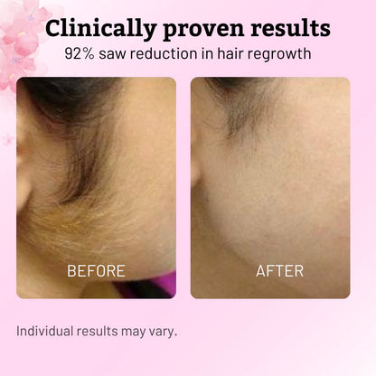 Glowyn Cyperus Hair Reduction Oil