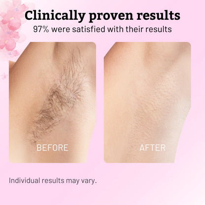 Glowyn Cyperus Hair Reduction Oil