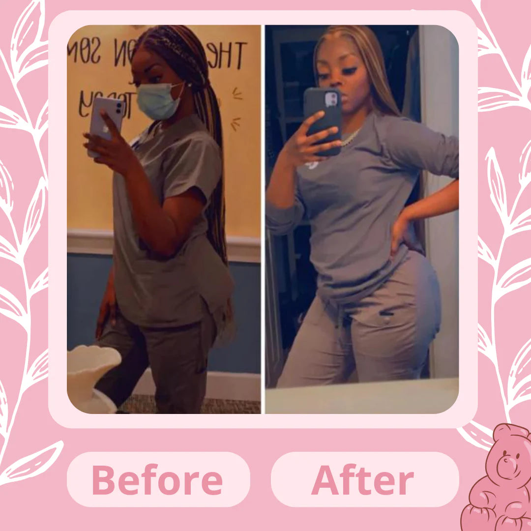 Glowyn™  Booty Bites | Glowup Bundle