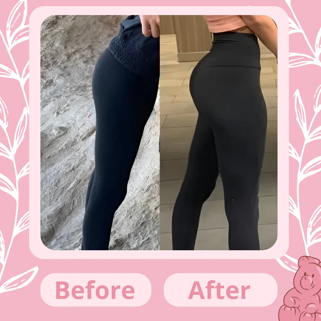 Glowyn™  Booty Bites | Glowup Bundle