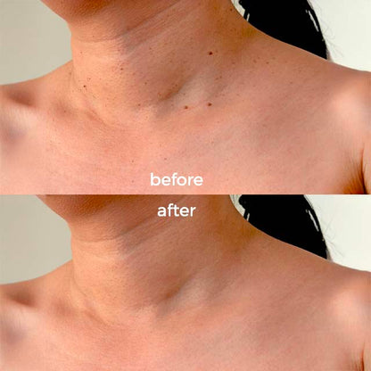 Goodbye Tags Kit - No More Skin Tags